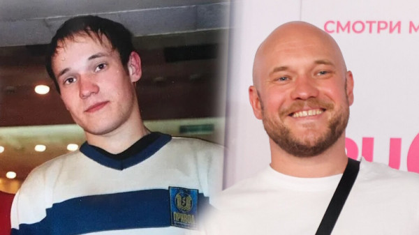 Самые знаменитые российские лысые актеры и как они выглядели с шевелюрами